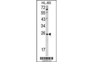 Image no. 1 for anti-NME/NM23 Nucleoside Diphosphate Kinase 4 (NME4) (AA 158-187), (C-Term) antibody (ABIN392785)