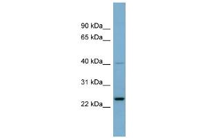Image no. 1 for anti-Nucleolar Protein 16 (NOP16) (Middle Region) antibody (ABIN2786964)