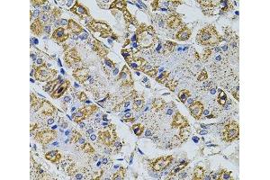 Immunohistochemistry of paraffin-embedded Human stomach using Gm13125 Polyclonal Antibody at dilution of 1:100 (40x lens).