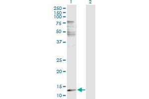 Image no. 2 for anti-Phospholipase A2, Group IIE (PLA2G2E) (AA 1-142) antibody (ABIN526258)