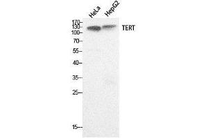Image no. 4 for anti-Telomerase Reverse Transcriptase (TERT) (Internal Region) antibody (ABIN3181058)