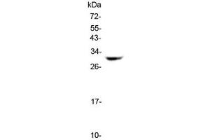 Image no. 1 for anti-Major Histocompatibility Complex, Class II, DQ beta 1 (HLA-DQB1) antibody (ABIN5647144)
