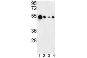 Image no. 5 for anti-Absent in Melanoma 2 (AIM2) (AA 1-50) antibody (ABIN3029828)