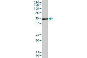 Image no. 3 for anti-Vaccinia Related Kinase 1 (VRK1) (AA 1-396) antibody (ABIN521349)