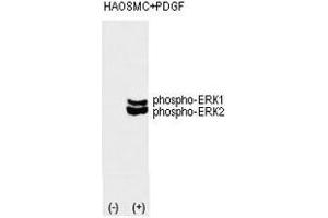 Image no. 2 for anti-Mitogen-Activated Protein Kinase 1/3 (MAPK1/3) (pThr202), (pTyr204) antibody (ABIN3031824)