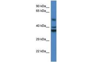 Image no. 1 for anti-Reticulon 4 Interacting Protein 1 (RTN4IP1) (AA 188-237) antibody (ABIN6746876)