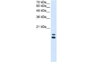 Image no. 1 for anti-Ubiquitously-Expressed, Prefoldin-Like Chaperone (UXT) (N-Term) antibody (ABIN629784)
