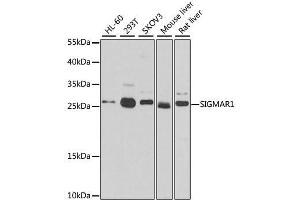 Image no. 3 for anti-sigma Non-Opioid Intracellular Receptor 1 (SIGMAR1) antibody (ABIN6147770)