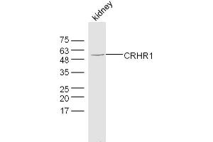 Image no. 1 for anti-Corticotropin Releasing Hormone Receptor 1 (CRHR1) (AA 55-150) antibody (ABIN5675214)