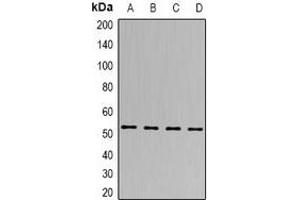 Image no. 2 for anti-tRNA-splicing Endonuclease Subunit SEN2 (TSEN2) antibody (ABIN3197804)