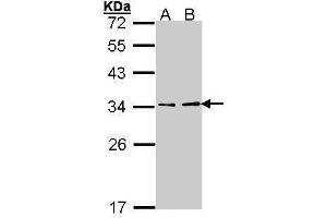 Image no. 1 for anti-ATPase, H+ Transporting, Lysosomal 31kDa, V1 Subunit E1 (ATP6V1E1) (Center) antibody (ABIN2855175)
