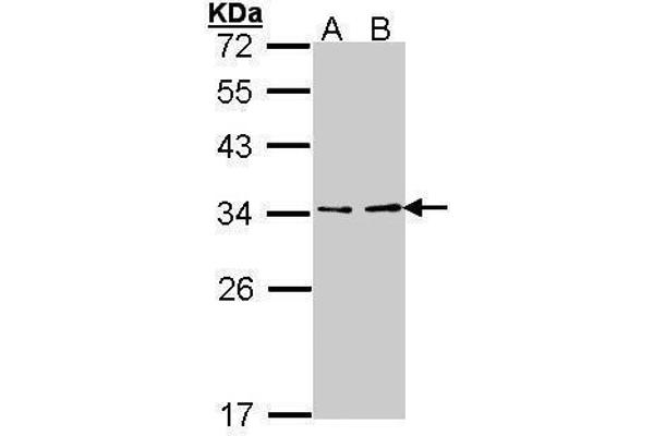 ATP6V1E1 anticorps  (Center)