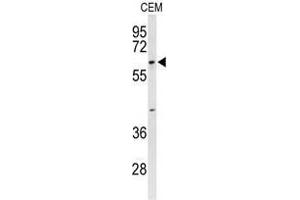 Image no. 3 for anti-Trichoplein, Keratin Filament Binding (TCHP) (AA 306-370), (Middle Region) antibody (ABIN955129)