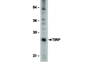 Image no. 1 for anti-Toll-Like Receptor Adaptor Molecule 2 (TICAM2) (C-Term) antibody (ABIN6655378)