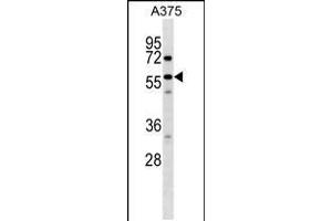 Image no. 1 for anti-Sorting Nexin 2 (SNX2) (AA 457-485), (C-Term) antibody (ABIN5532128)