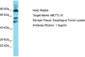 Image no. 1 for anti-Methyltransferase Like 16 (METTL16) (Middle Region) antibody (ABIN2783084)