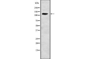 Western blot analysis of USP37 expression in Hela cell lysate,The lane on the left is treated with the antigen-specific peptide.