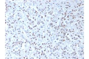 Image no. 3 for anti-Wilms Tumor 1 (WT1) antibody (ABIN6940904)