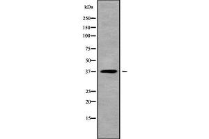 Image no. 1 for anti-TWIST Neighbor (TWISTNB) (C-Term) antibody (ABIN6265812)