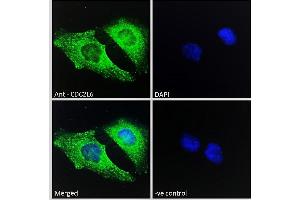 Image no. 1 for anti-Cyclin-Dependent Kinase 19 (CDK19) (C-Term) antibody (ABIN570894)