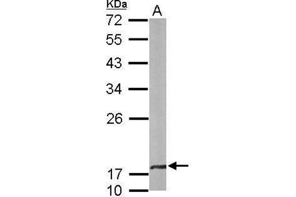 anti-Crystallin, beta A4 (CRYbA4) (Center) antibody