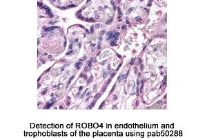 Image no. 2 for anti-Roundabout, Axon Guidance Receptor, Homolog 4 (ROBO4) (AA 200-300), (Internal Region) antibody (ABIN363597)