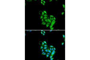 Image no. 2 for anti-PHD Finger Protein 17 (PHF17) antibody (ABIN1980353)