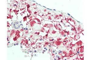 Image no. 2 for anti-Osteoglycin (OGN) (AA 246-276) antibody (ABIN1920588)