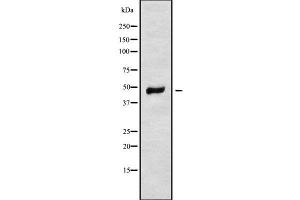 anti-Mitochondrial Ribosomal Protein S31 (MRPS31) (Internal Region) antibody