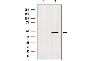 Image no. 3 for anti-Matrix Metallopeptidase 28 (MMP28) (Internal Region) antibody (ABIN6263303)