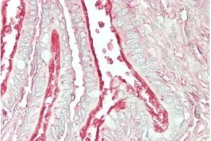 ABIN768580 (5µg/ml) staining of paraffin embedded Human Lung.