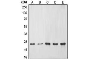 Image no. 1 for anti-ES cell expressed Ras (ERAS) (C-Term) antibody (ABIN2704771)