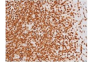 Image no. 2 for anti-REL proto-oncogene (c-Rel) (pSer503) antibody (ABIN6255382)