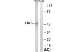 Image no. 1 for anti-Histone Acetyltransferase 1 (HAT1) (AA 331-380) antibody (ABIN2889272)