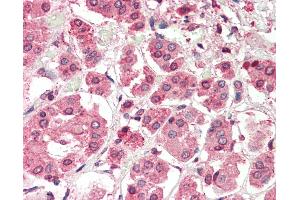 Image no. 3 for anti-Pre-B-Cell Leukemia Homeobox Protein 2 (PBX2) (N-Term) antibody (ABIN6754928)
