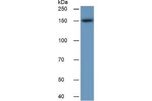 Image no. 4 for Carcinoembryonic Antigen Gene Family (CEA) ELISA Kit (ABIN6730922)
