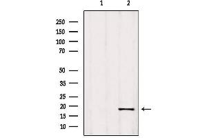 Image no. 1 for anti-Ribonuclease P/MRP 25 Subunit-Like (RPP25L) antibody (ABIN6260374)