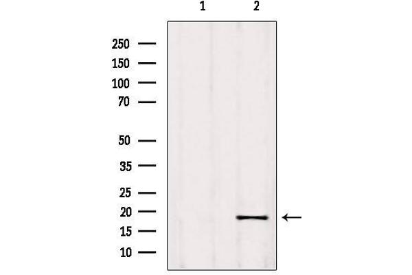 anti-Ribonuclease P/MRP 25 Subunit-Like (RPP25L) (C-Term) antibody