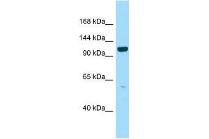 Image no. 1 for anti-Liprin-beta-2 (PPFIBP2) (C-Term) antibody (ABIN2790675)