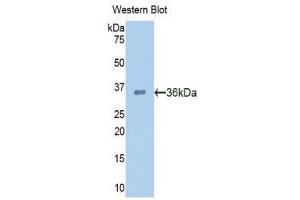 Image no. 1 for anti-Proprotein Convertase Subtilisin/kexin Type 9 (PCSK9) (AA 156-461) antibody (ABIN1860147)