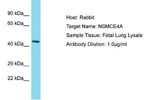 Image no. 1 for anti-Non-SMC Element 4 Homolog A (NSMCE4A) (C-Term) antibody (ABIN2791705)