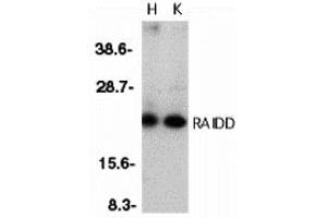 Western Blotting (WB) image for anti-CASP2 and RIPK1 Domain Containing Adaptor with Death Domain (CRADD) (Middle Region) antibody (ABIN1031051)