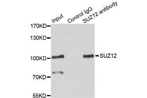 Image no. 3 for anti-SUZ12 Polycomb Repressive Complex 2 Subunit (SUZ12) antibody (ABIN6571363)