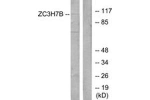 Image no. 1 for anti-Zinc Finger CCCH-Type Containing 7B (ZC3H7B) (AA 851-900) antibody (ABIN1534172)
