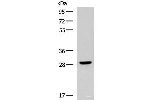 Western blot analysis of Human fetal brain tissue lysate using CLEC9A Polyclonal Antibody at dilution of 1:800
