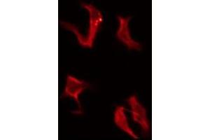 Image no. 1 for anti-Olfactory Receptor, Family 4, Subfamily A, Member 16 (OR4A16) antibody (ABIN6259382)