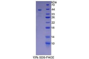 Image no. 1 for Mucin 5 Subtype B (MUC5B) protein (ABIN3010771)