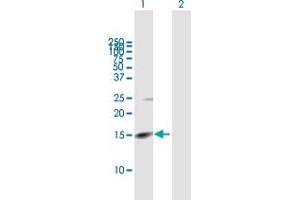 Image no. 1 for anti-Rhomboid, Veinlet-Like 2 (RHBDL2) (AA 1-121) antibody (ABIN527258)