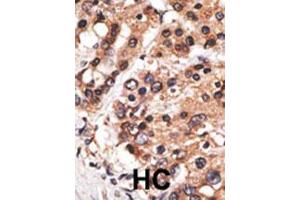 Image no. 2 for anti-Protein AF-9 (MLLT3) (AA 471-502), (C-Term) antibody (ABIN390128)