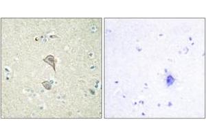 Image no. 1 for anti-Natural Killer-Tumor Recognition Sequence (NKTR) (AA 784-833) antibody (ABIN1533692)